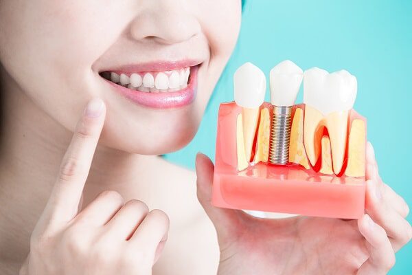 Dental teeth whitening